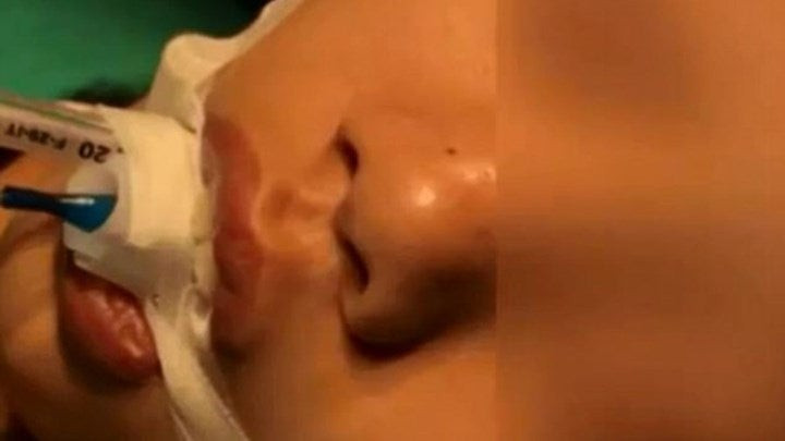 10χρονη υπεβλήθη σε εγχείρηση ανοιχτού εγκεφάλου μετά από αυτό το απλό πράγμα που της έκανε η μάνα της (εικόνες)